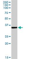 Anti-UNG Rabbit Polyclonal Antibody