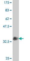 Anti-PRSS1 Mouse Polyclonal Antibody