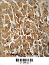 Anti-ATP5G2 Rabbit Polyclonal Antibody (Biotin)