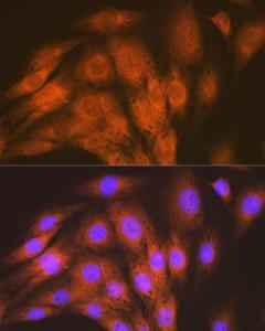 Anti-ALK-1 Rabbit Monoclonal Antibody [clone: ARC1735]