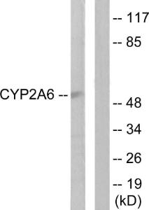 Western blot analysis of lysates from Jurkat cells using Anti-Cytochrome P450 2A6 Antibody The right hand lane represents a negative control, where the antibody is blocked by the immunising peptide