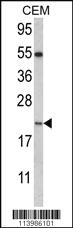 Anti-NANOS2 Rabbit Polyclonal Antibody