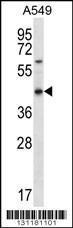 Anti-OR51S1 Rabbit Polyclonal Antibody (AP (Alkaline Phosphatase))