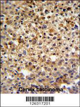 Anti-CCDC180 Rabbit Polyclonal Antibody (FITC (Fluorescein Isothiocyanate))