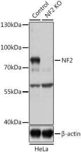 Antibody anti-NF2 100 µl