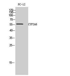 Western blot analysis of PC 12 cells using Anti-Cytochrome P450 2A6 Antibody