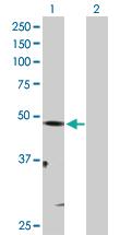 Anti-MITF Rabbit Polyclonal Antibody