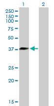 Anti-DNAJB6 Mouse Polyclonal Antibody