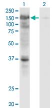 Anti-USP4 Mouse Monoclonal Antibody [clone: 5E12]