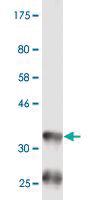 Anti-BAAT Mouse Monoclonal Antibody [clone: 1E4]