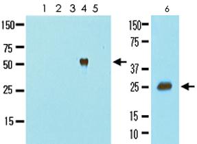 Anti-CTSL Mouse Monoclonal Antibody [clone: 2H7]