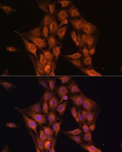 Antibody anti-NF2 100 µl