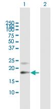 Anti-PTGDS Mouse Polyclonal Antibody