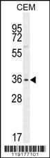 Anti-MSI1 Rabbit Polyclonal Antibody (HRP (Horseradish Peroxidase))