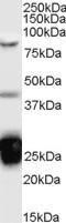 Anti-TIA1 Antibody (A83311) (01 µg/ml) staining of Jurkat cell lysate (35 µg protein in RIPA buffer) Detected by chemiluminescence