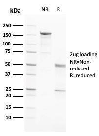 Antibody anti-PAPP A PAPPA2717 100 µg