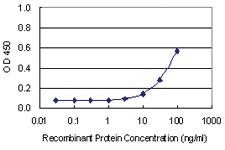 Anti-C21ORF2 Mouse Monoclonal Antibody [clone: 1E4]