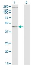 Anti-STEAP1 Mouse Monoclonal Antibody [clone: 4F6-1F3]