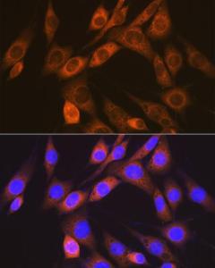 Anti-ALK-1 Rabbit Monoclonal Antibody [clone: ARC1735]