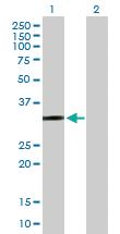 Anti-PTGER2 Mouse Polyclonal Antibody