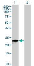 Anti-SNX10 Mouse Polyclonal Antibody