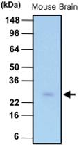 Anti-PSPH Mouse Monoclonal Antibody [clone: 3G12]