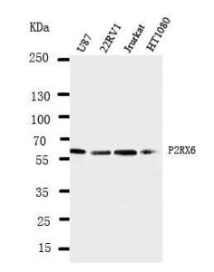 Anti-P2X6 Rabbit Polyclonal Antibody