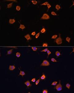 Antibody anti-NF2 100 µl