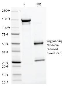 SDS-PAGE analysis of Anti-Glycoprotein 2 Antibody [GP2/1805] under non-reduced and reduced conditions; showing intact IgG and intact heavy and light chains, respectively SDS-PAGE analysis confirms the integrity and purity of the antibody