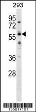 Anti-NELFB Rabbit Polyclonal Antibody (AP (Alkaline Phosphatase))