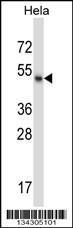 Anti-MSL1 Rabbit Polyclonal Antibody (AP (Alkaline Phosphatase))