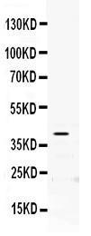 Anti-PON2 Rabbit Polyclonal Antibody