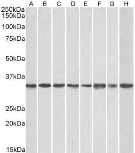 Antibody anti-GNB2 100 µg