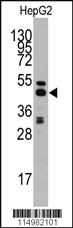 Anti-S adenosylhomocysteine hydrolase (ACHY) Rabbit Polyclonal Antibody