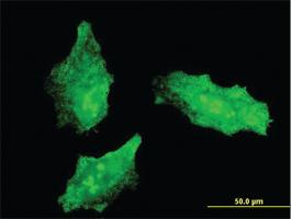 Anti-MKI67 Mouse Monoclonal Antibody [clone: 7B8]