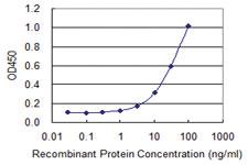 Anti-FOXQ1 Mouse Monoclonal Antibody [clone: 1A10]