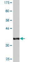 Anti-SLC20A2 Mouse Monoclonal Antibody [clone: 4B1]