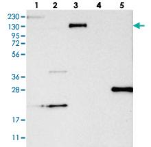 Anti-KIAA0556 Rabbit Polyclonal Antibody