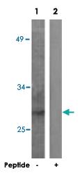 Anti-TNNI3 Rabbit Polyclonal Antibody