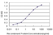 Anti-MKI67 Mouse Monoclonal Antibody [clone: 7B8]