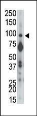 Anti-PPP2R4 Rabbit Polyclonal Antibody (APC (Allophycocyanin))