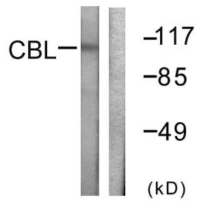 Western blot analysis of lysates from HeLa cells, treated with EGF 200ng/ml 30' using Anti-CBL Antibody. The right hand lane represents a negative control, where the antibody is blocked by the immunising peptide.