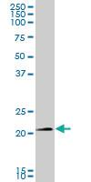 Anti-SNX10 Mouse Polyclonal Antibody