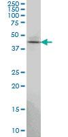 Anti-TSSC1 Mouse Monoclonal Antibody [clone: 2H5]