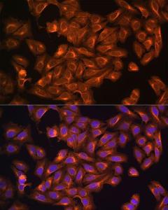 Antibody anti-NF2 100 µl