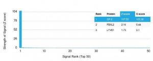 Analysis of protein array containing more than 19,000 full-length human proteins using Anti-Glycoprotein 2 Antibody [GP2/1805] Z-Score and S- Score