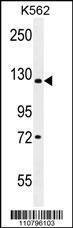 Anti-KDM4C Rabbit Polyclonal Antibody (PE (Phycoerythrin))