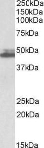 Anti-SH3GL1 antibody