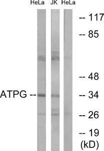 Western blot analysis of lysates from HeLa cells and Jurkat cells using Anti-ATPG Antibody The right hand lane represents a negative control, where the antibody is blocked by the immunising peptide