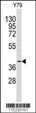 Anti-AKR1A1 Rabbit Polyclonal Antibody